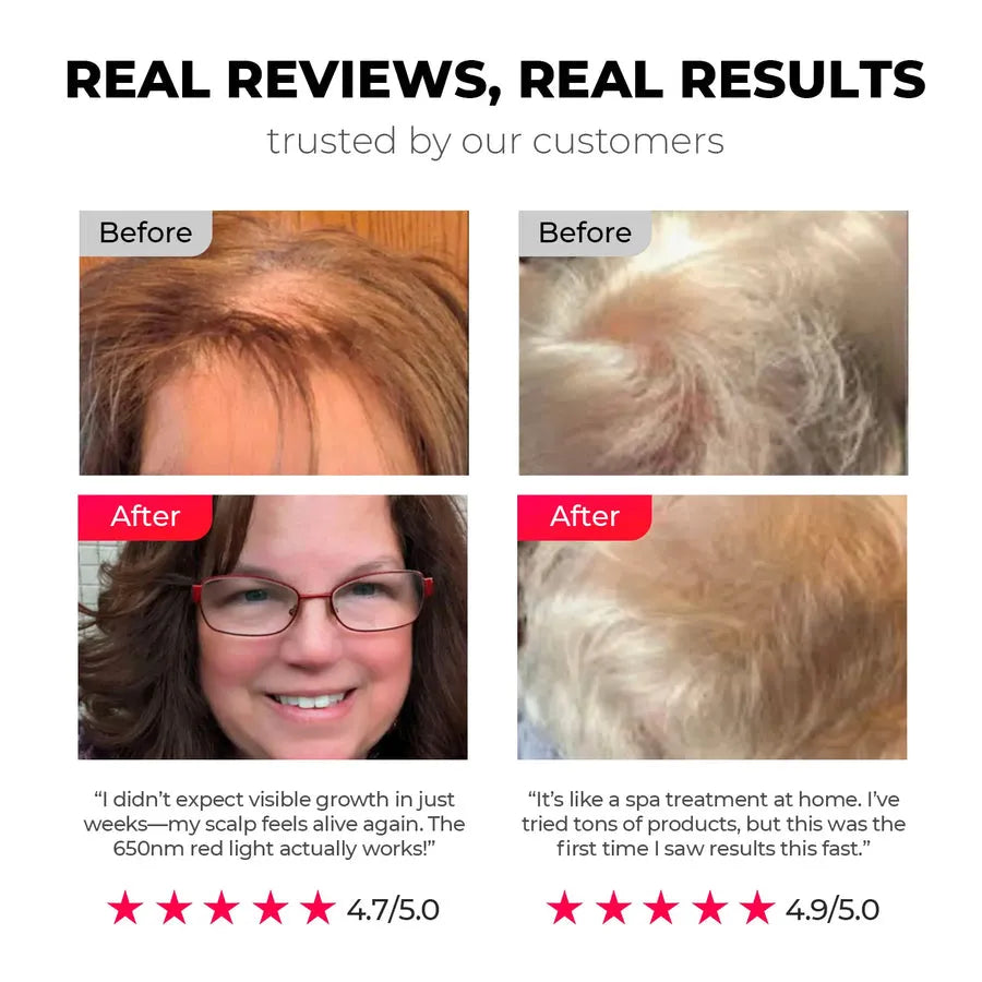 TYMO TriThera Hair Brush